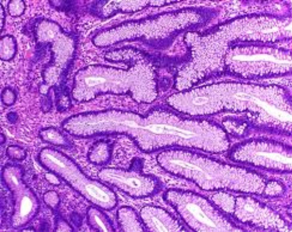 Anotaciones importantes