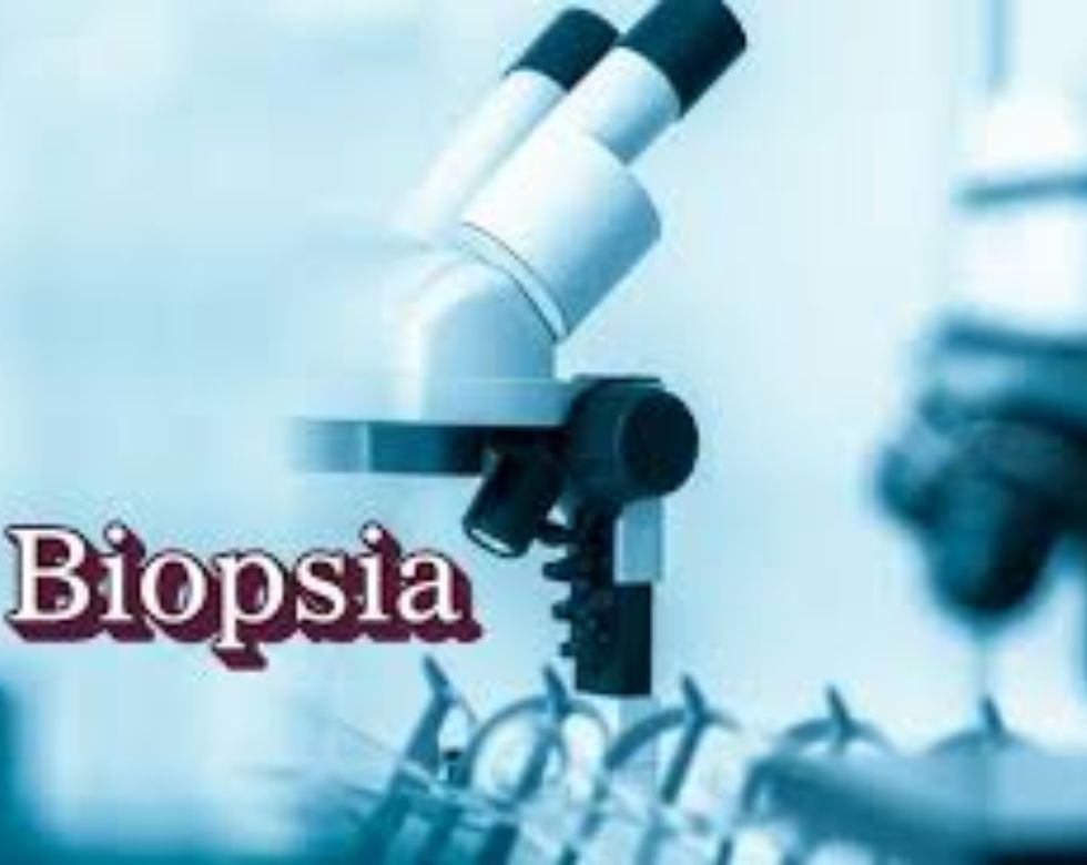 ¿Qué es una biopsia?